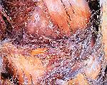 close up -- trunk of palm tree